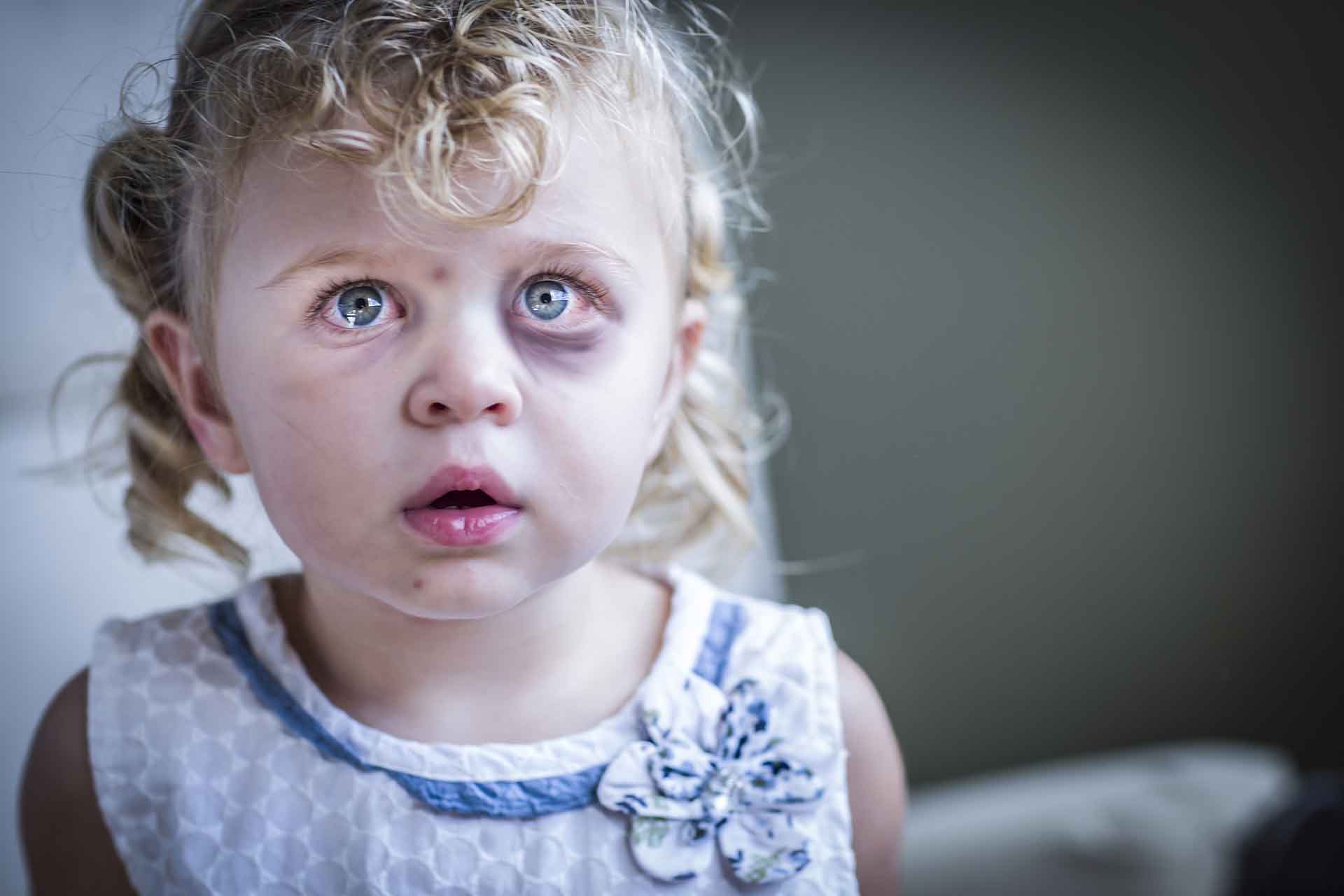 Zware mishandeling baby's — Weening Strafrechtadvocaten Spraakmakende strafzaken - Zware mishandeling baby's